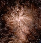 Revivogen_Polmax_1przed_kuracja.jpg Revivogen_Polmax_1przed_kuracja.jpg