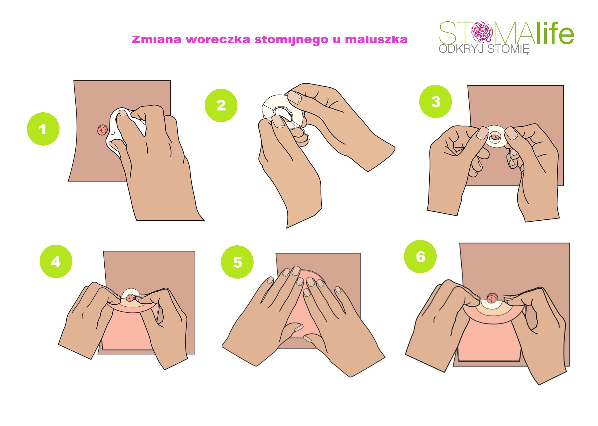 zmiana_sprz_tu_stomijnego