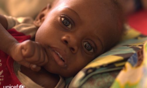 Głód zabija dzieci w Afryce Wschodniej i Południowej!